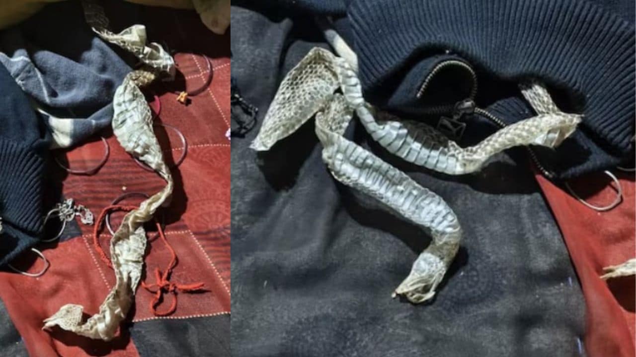 UP Woman Missing, Family Finds 5&Foot 'Snake Skin' On Bed