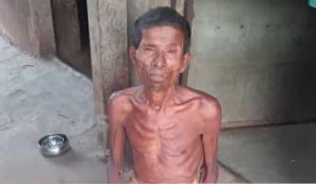 Odisha Man Rapes Specially&Abled Daughter. She Gives Birth To Baby Girl