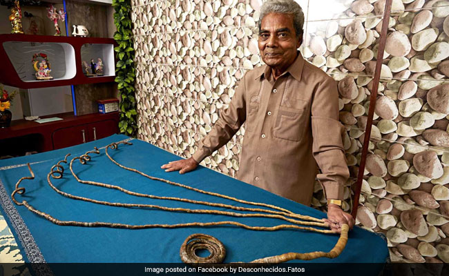 Pune Man With Longest Fingernails Finds Hand Disabled After Cutting Them