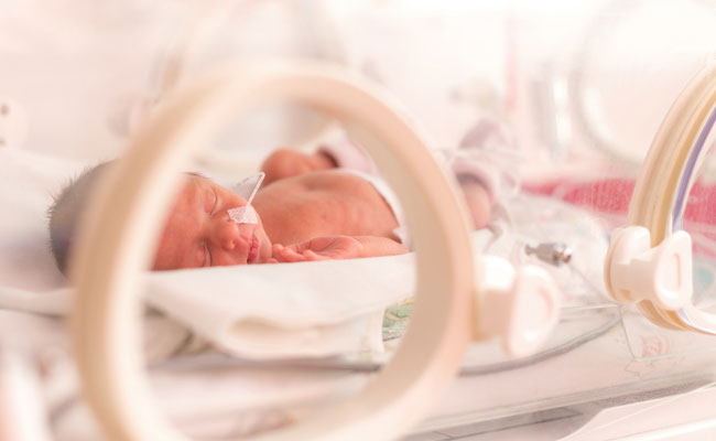 Only a minority of babies born to mothers with HIV infection get the infection from their mothers