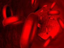 Platelet Count: 7 Best Foods To Boost Platelets Naturally Platelet Count: 7 Best Foods To Boost Platelets Naturally