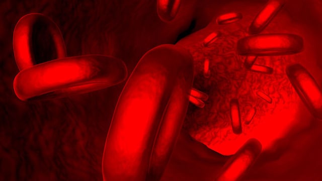 Platelet is what your blood needs in order to clot each time an injury takes place