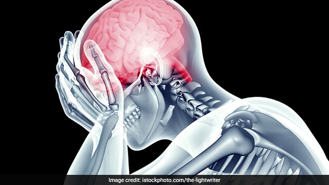 Haemorrhagic stroke leads to ruptured blood vessel which causes bleeding in the brain
