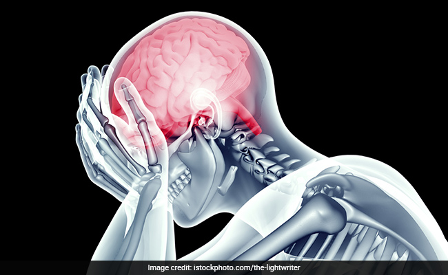 Haemorrhagic stroke leads to ruptured blood vessel which causes bleeding in the brain