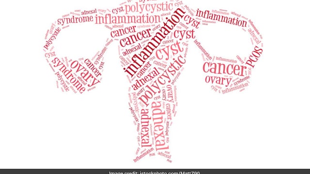 PCOD is lifestyle related hormonal disorder which affects menstrual cycle of women