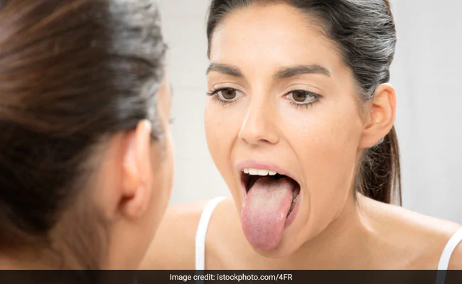 Your tongue patterns could be indicative of an underlying health condition