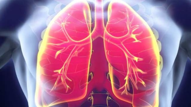 World Lung Cancer Day 2018 is aimed at raising awareness about lung cancer