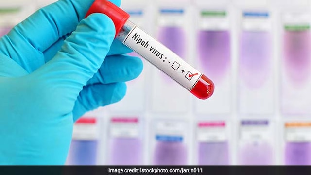 Nipah virus: It can cause fever and fatigue