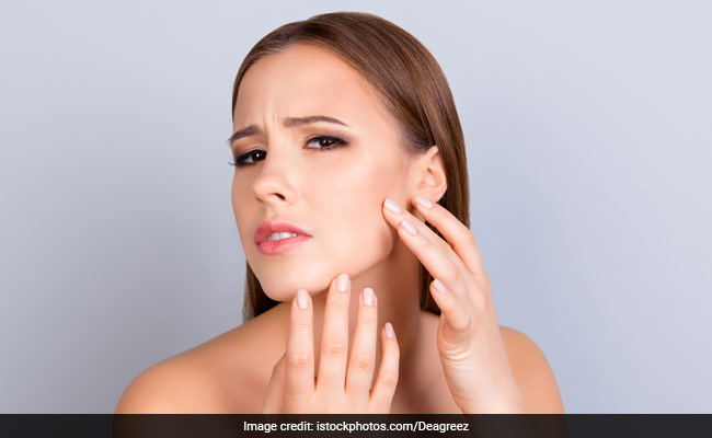 Foods That Make Your Skin Oily And Lifeless