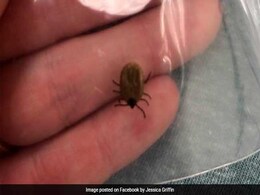 A 5-Year-Old Was Suddenly Paralysed. Then Her Mother Checked Her Scalp A 5-Year-Old Was Suddenly Paralysed. Then Her Mother Checked Her Scalp