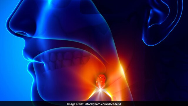 Many white blood cells are present in tonsils, which work for the body's immunity