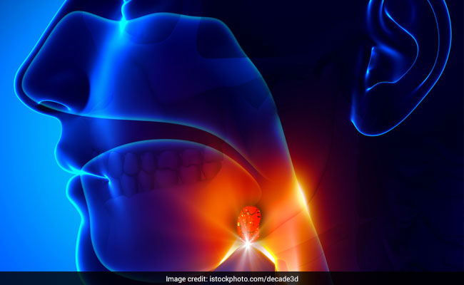 Many white blood cells are present in tonsils, which work for the body's immunity