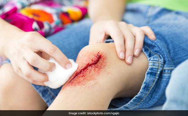 Home remedies for minor cuts including washing the cut immediately to remove dirt and bacteria