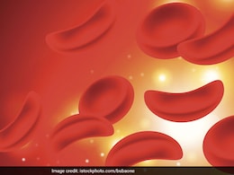 Early Diagnosis Of Sickle Cell Anemia Matters: Newborn Screening And Timely Intervention