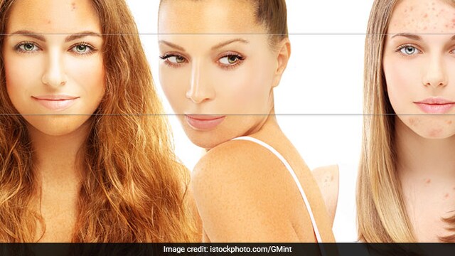 Everything you should know about skin pigmentation