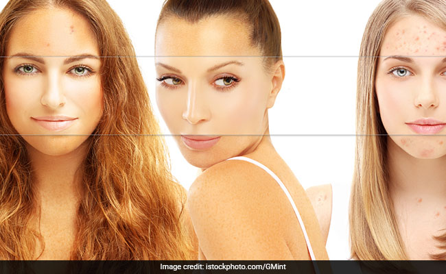 Everything you should know about skin pigmentation