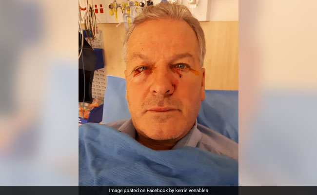 Man Undergoes Plastic Surgery After Being Attacked By "Dead" Kangaroo