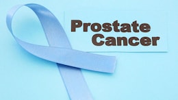 Prostate Cancer Screening Rejected By UK Government Advisers: Here's Why