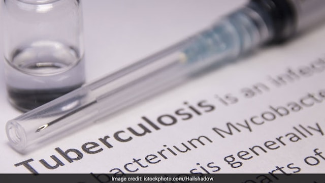 WHO, in its latest 2018 Global TB Report, says countries are still not doing enough to end TB by 2030