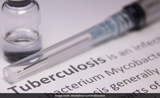 WHO, in its latest 2018 Global TB Report, says countries are still not doing enough to end TB by 2030