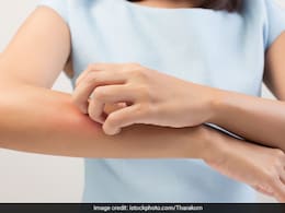 These Diet Tips Can Help Manage Psoriasis