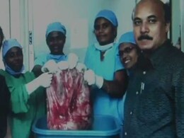 "World's Heaviest Ovarian Cancer Tumour" Removed By Doctors In Tamil Nadu "World's Heaviest Ovarian Cancer Tumour" Removed By Doctors In Tamil Nadu