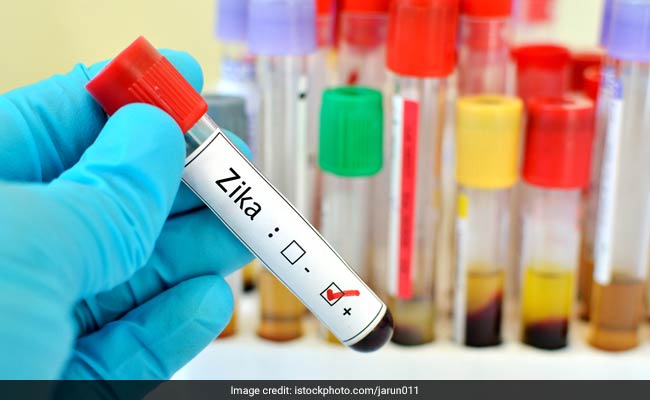 Eight New Zika Cases Detected in Rajasthan