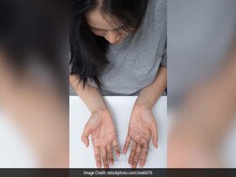 Is Your Hair Falling Out? Address The Root Cause To Save Your Locks; Here Are Some Possible Causes Is Your Hair Falling Out? Address The Root Cause To Save Your Locks; Here Are Some Possible Causes