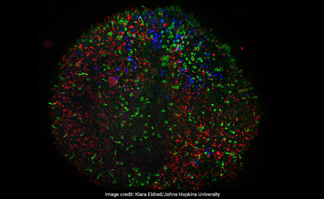 Scientists Grow Tiny Human Retinas In A Dish