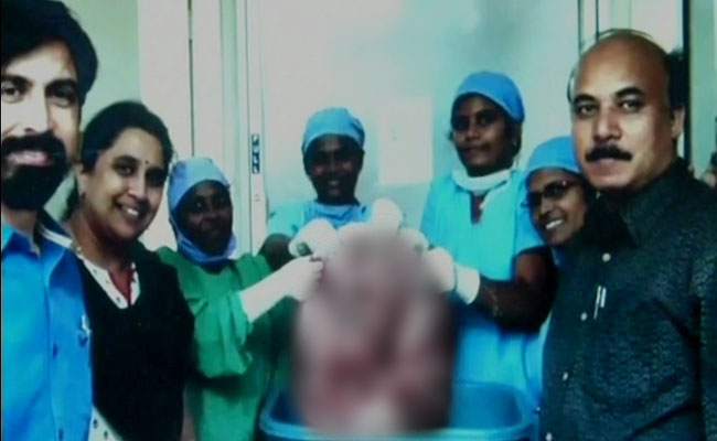 भारत में डॉक्टर्स ने महिला के पेट से निकाला दुनिया का सबसे भारी ट्यूमर, वजन था 33 किलो