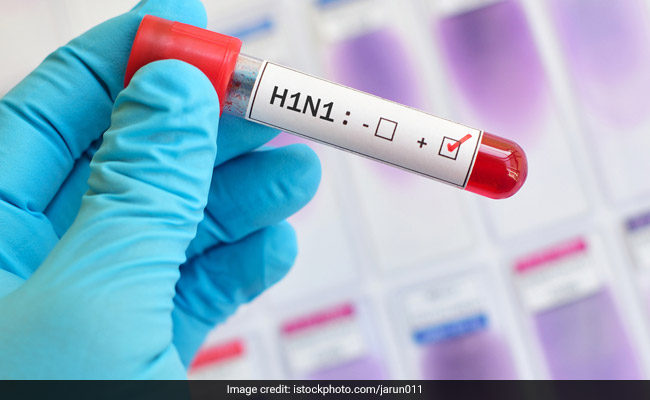 Over 130 Cases Of Swine Flu Detected In Mumbai In 2 Weeks: Civic Body