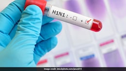 41-Year-Old Karnataka Man Dies Of Swine Flu: Symptoms, Risks And Prevention