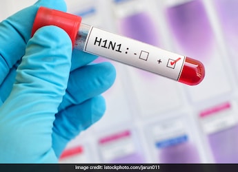 41-Year-Old Karnataka Man Dies Of Swine Flu: Symptoms, Risks And Prevention