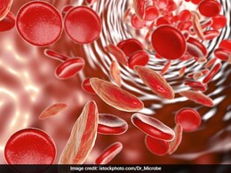 World Sickle Cell Day 2024: Know Symptoms, Risk Factors And Complications For This Condition