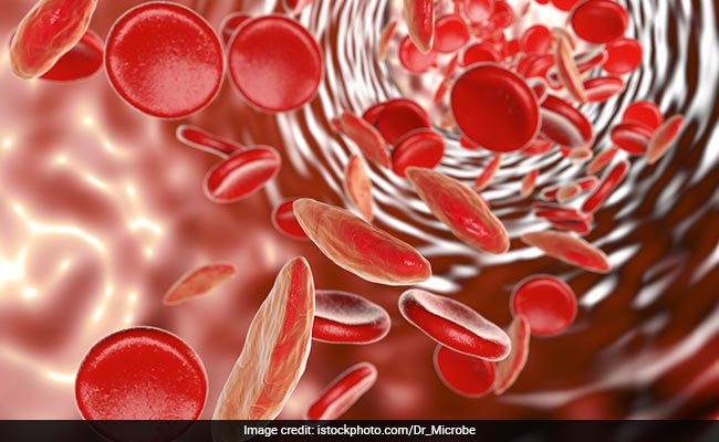 A diet with low levels of iron can increase the risk of anemia