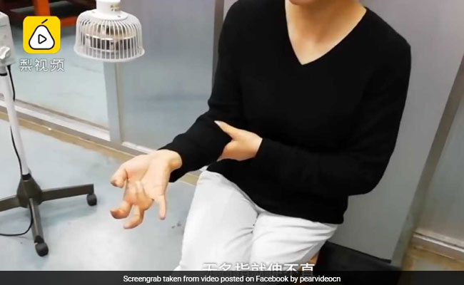 7 दिन तक लगातार फोन इस्तेमाल करती रही महिला, हाथों का हुआ ऐसा हाल, देखें VIDEO