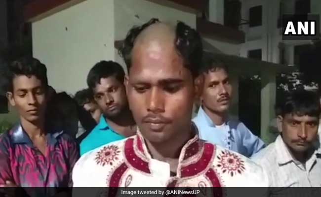 Lucknow Groom's Head Shaved Allegedly By Bride's Family Over Dowry