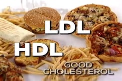 Doctors On Call: Lipid Profile Doctors On Call: Lipid Profile