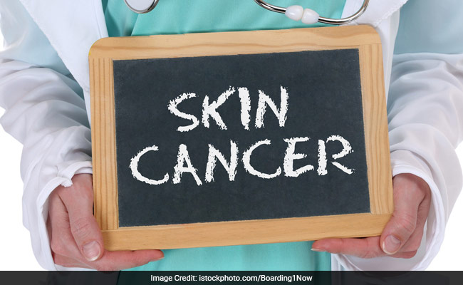 Novel Protein Linked To Skin Cancer Identified
