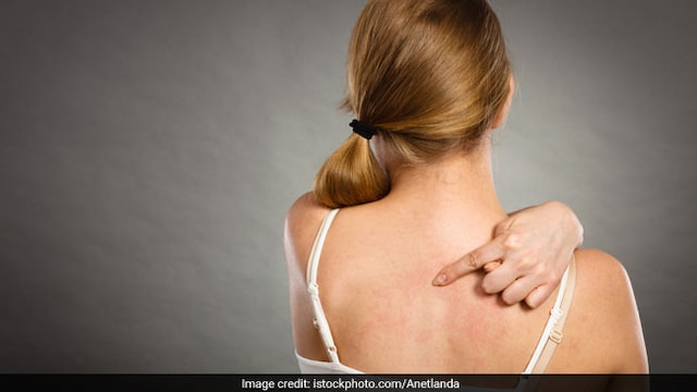 Small Bumps On Your Back Making You Scratch? Here's What You Can Do