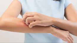 Is It Chickenpox? Signs, Medicines, Care Tips And Precautions For Children