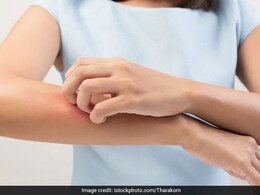 भारत में मिला चिकनपॉक्स फैलाने वाले वायरस का नया वैरिएंट क्लैड 9, जानें क्या हैं लक्षण