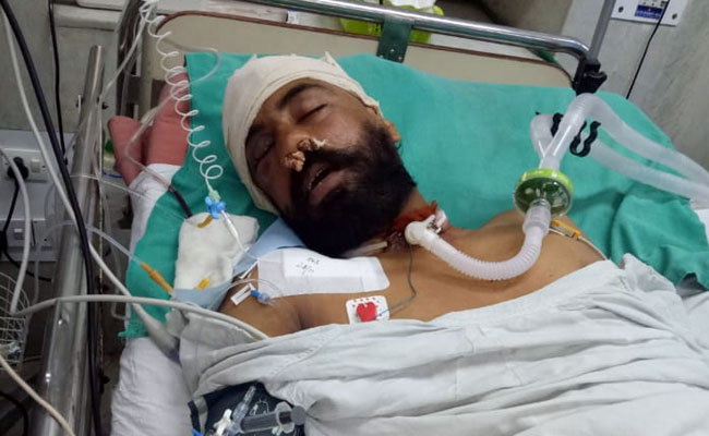 अस्पताल में जिंदगी की जंग लड़ रहा जांबाज, घाटी में पत्थरबाजों ने कर दिया था जख्मी