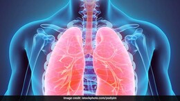 World COPD Day 2024: These Lifestyle Changes Can Improve Your Lung Health