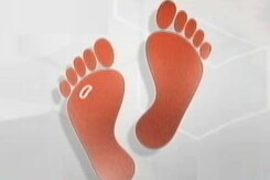 Doctors On Call: Importance Of Footcare In Diabetes Doctors On Call: Importance Of Footcare In Diabetes