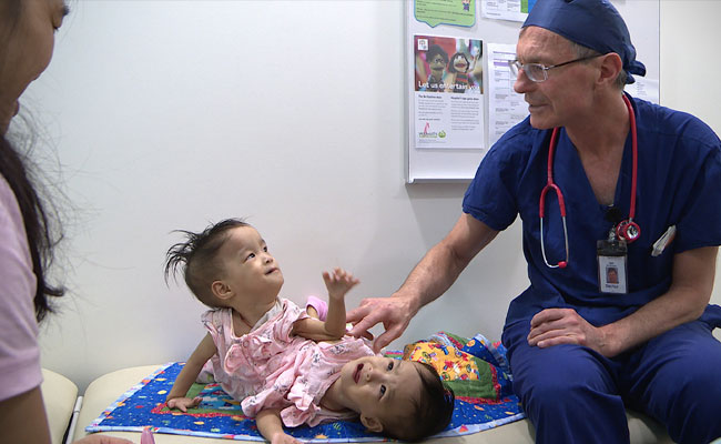 Conjoined Bhutanese Twins Who Share Liver To Undergo Separation Surgery