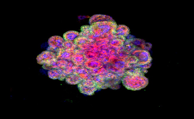 Scientists Create 'Mini Human Placenta' Organoids In A Lab Dish