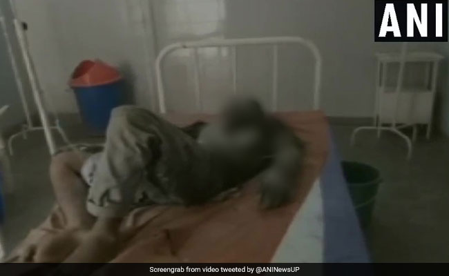 Man Locked Inside Girlfriend's Home, Set On Fire Allegedly By Her Family