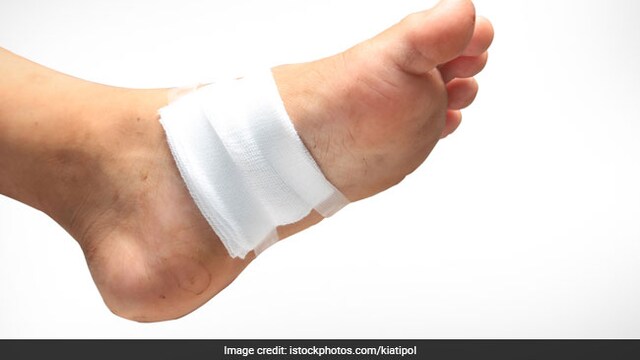 A lot of sugar in the bloodstream slows the ulcer healing process.