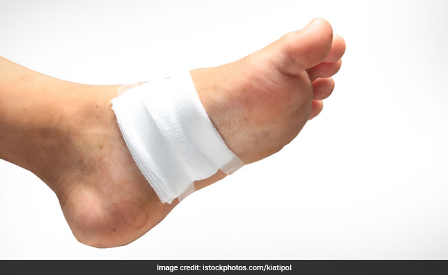 A lot of sugar in the bloodstream slows the ulcer healing process.